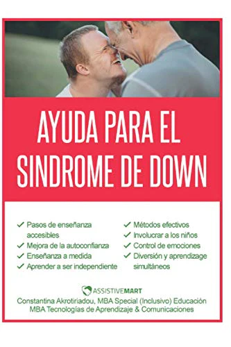 Ayuda para el Sindrome de Down