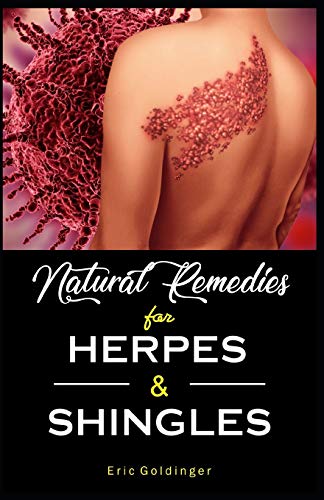 Natural Remedies For HERPES & SHINGLES
